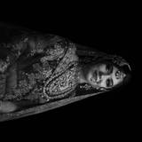 Renu