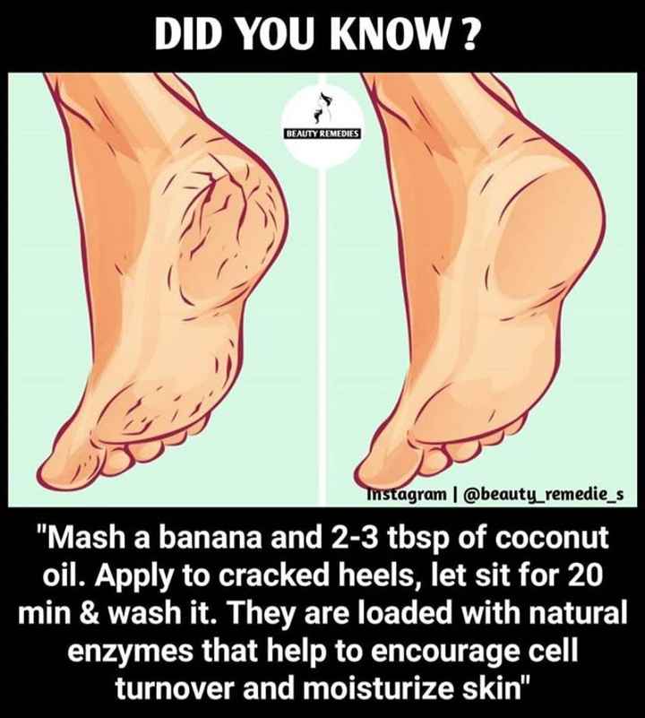 a diy home remedy for cracked heels. - 1
