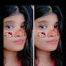 Rohit