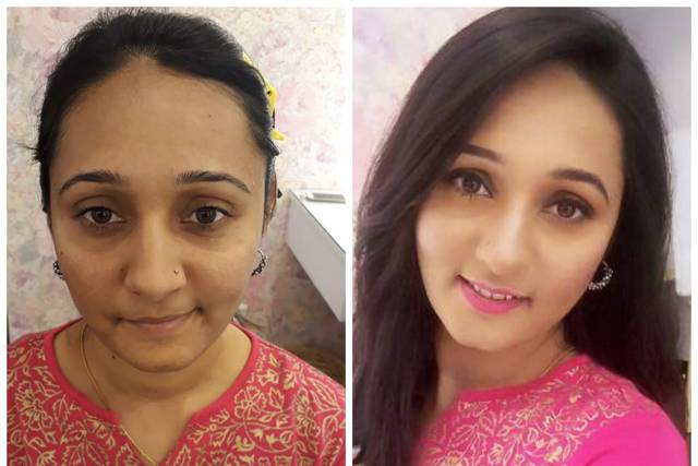 Before and after